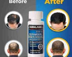 Minoxidil Kirkland 5% losyon