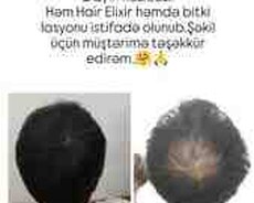 Saç tökülməsinə qarşı serum